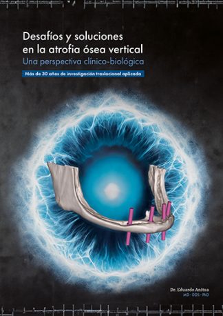 Desafíos y soluciones en la atrofia ósea vertical