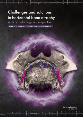 Challenges and solutions in horizontal bone atrophy