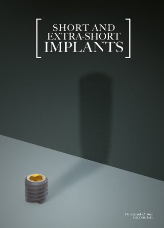 Short and Extra-Short implants