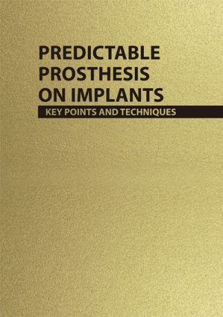 Predictable Prosthesis on Implants - Key points and techniques