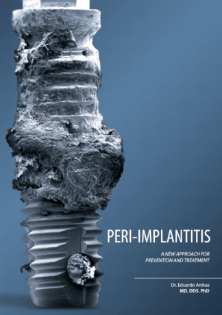 Periimplantitis - Un nuevo enfoque a la prevención y su tratamiento