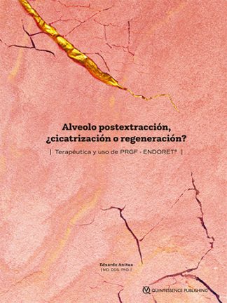Alveolo postextracción, ¿cicatrización o regeneración? Terapéutica y uso de PRGF - ENDORET®
