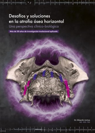 Desafíos y soluciones en la atrofia ósea horizontal